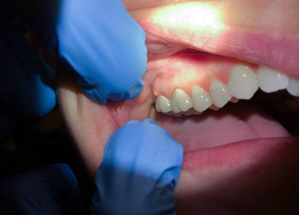 Best Emergency Treatment for Jaw Pain or Injury in Charleston, SC